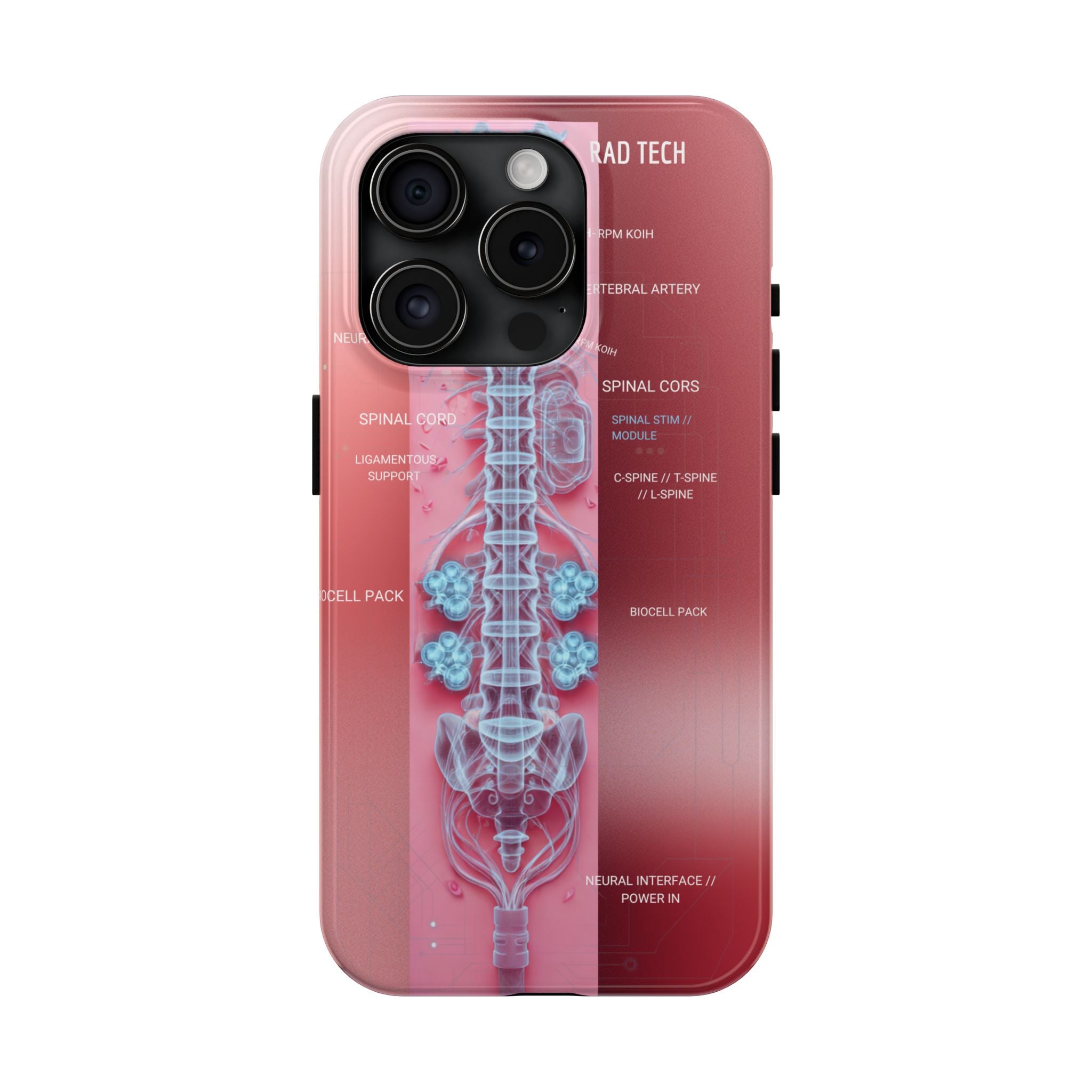 Anatomical Spine Tough Phone Case — Medical X-Ray Design, ‘Spinal Cord’ Labelled