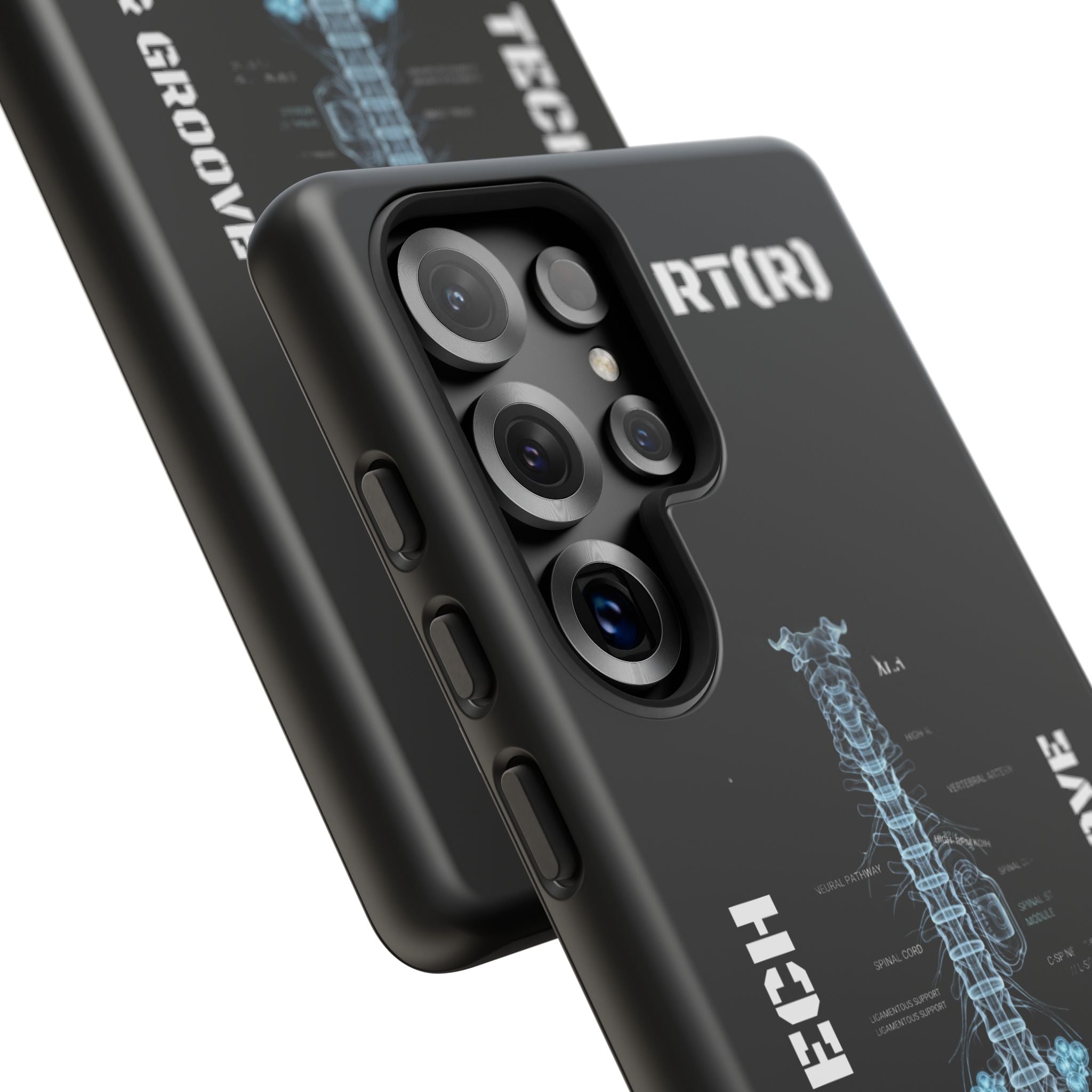 RAD TECH -Aesthetic Phone Case