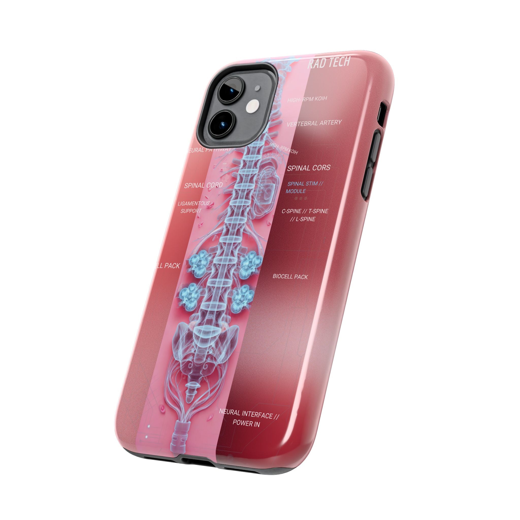 Anatomical Spine Tough Phone Case — Medical X-Ray Design, ‘Spinal Cord’ Labelled