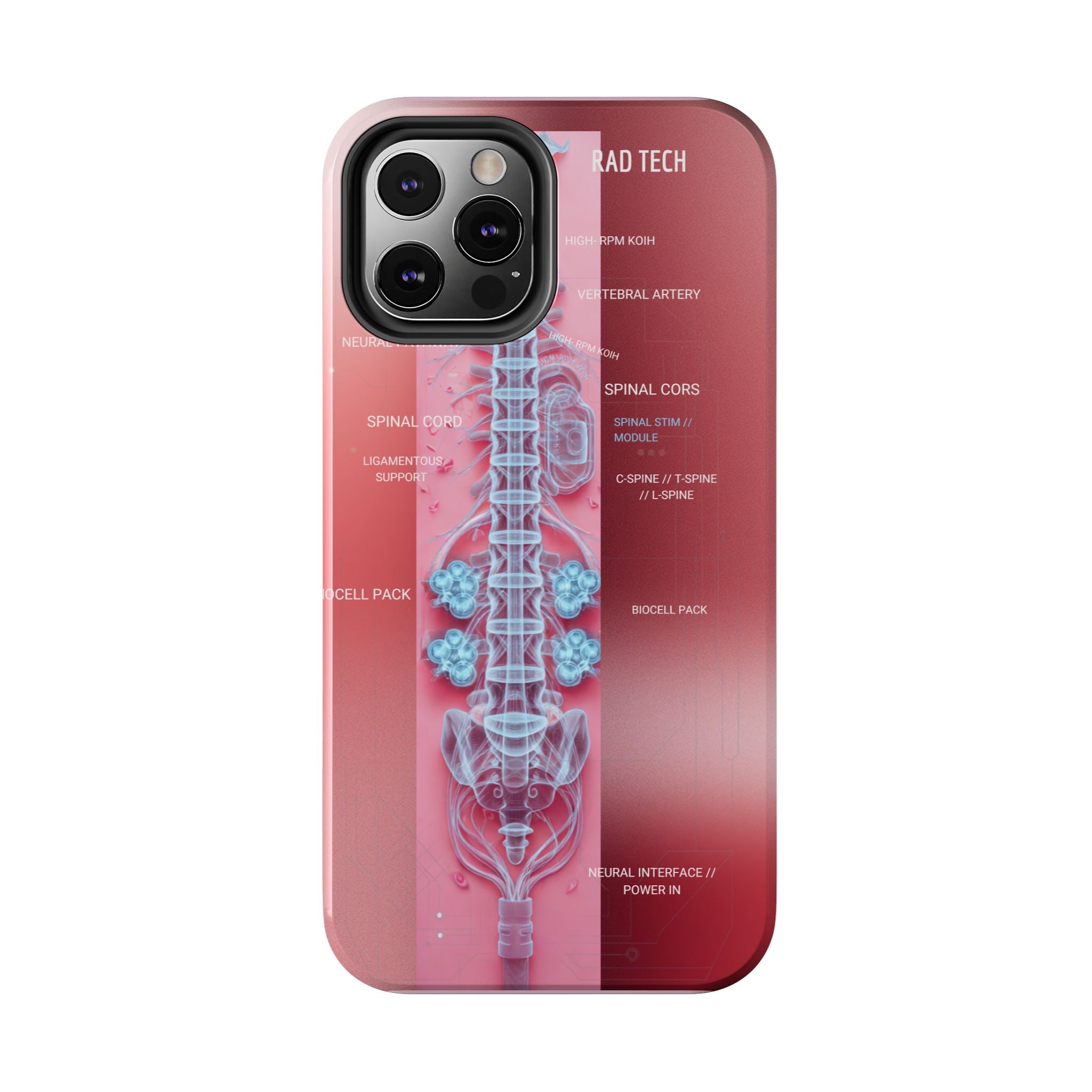 Anatomical Spine Tough Phone Case — Medical X-Ray Design, ‘Spinal Cord’ Labelled