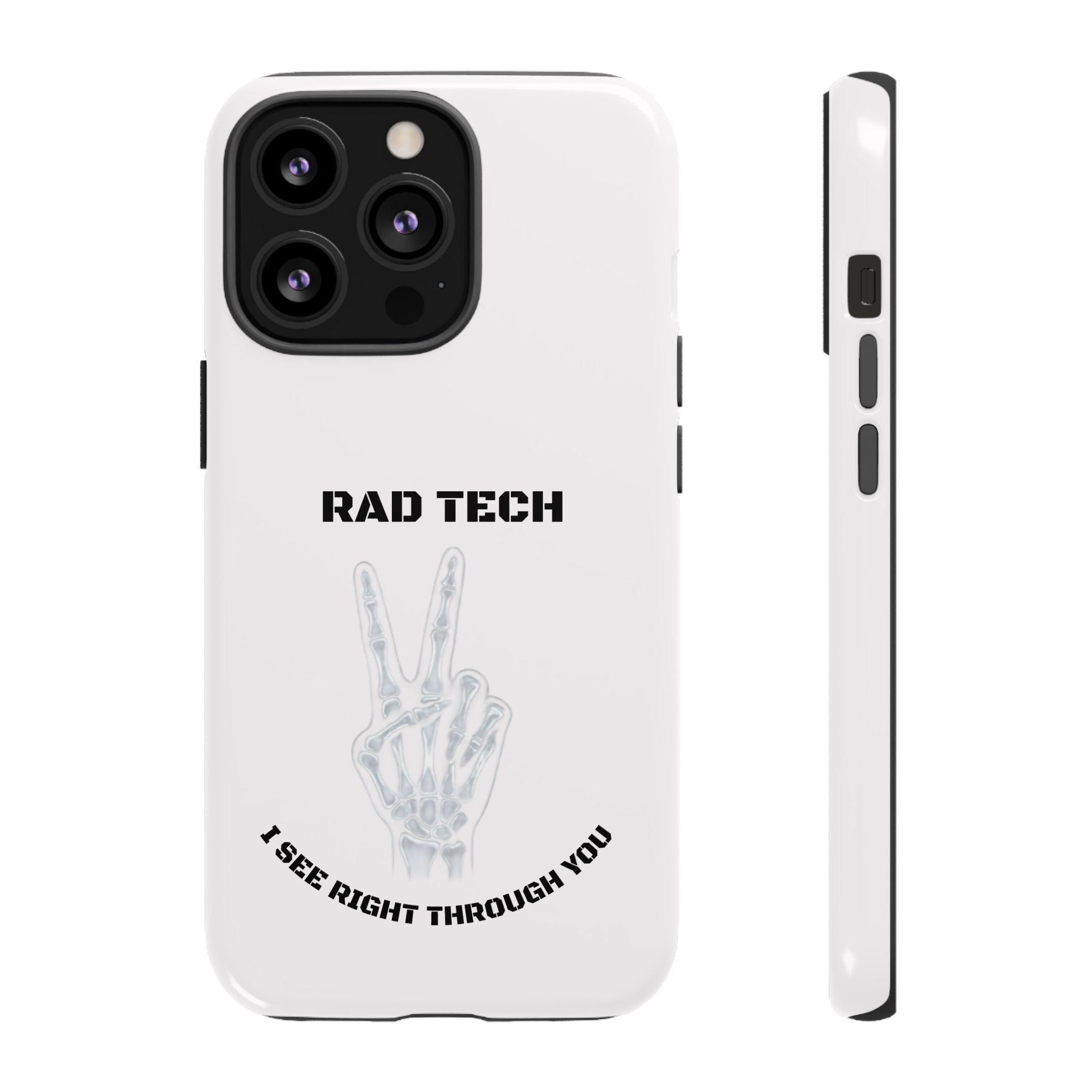 Rad Tech Phone Case — Skeleton Hand "I See Right Through You" X-ray Technician Gift