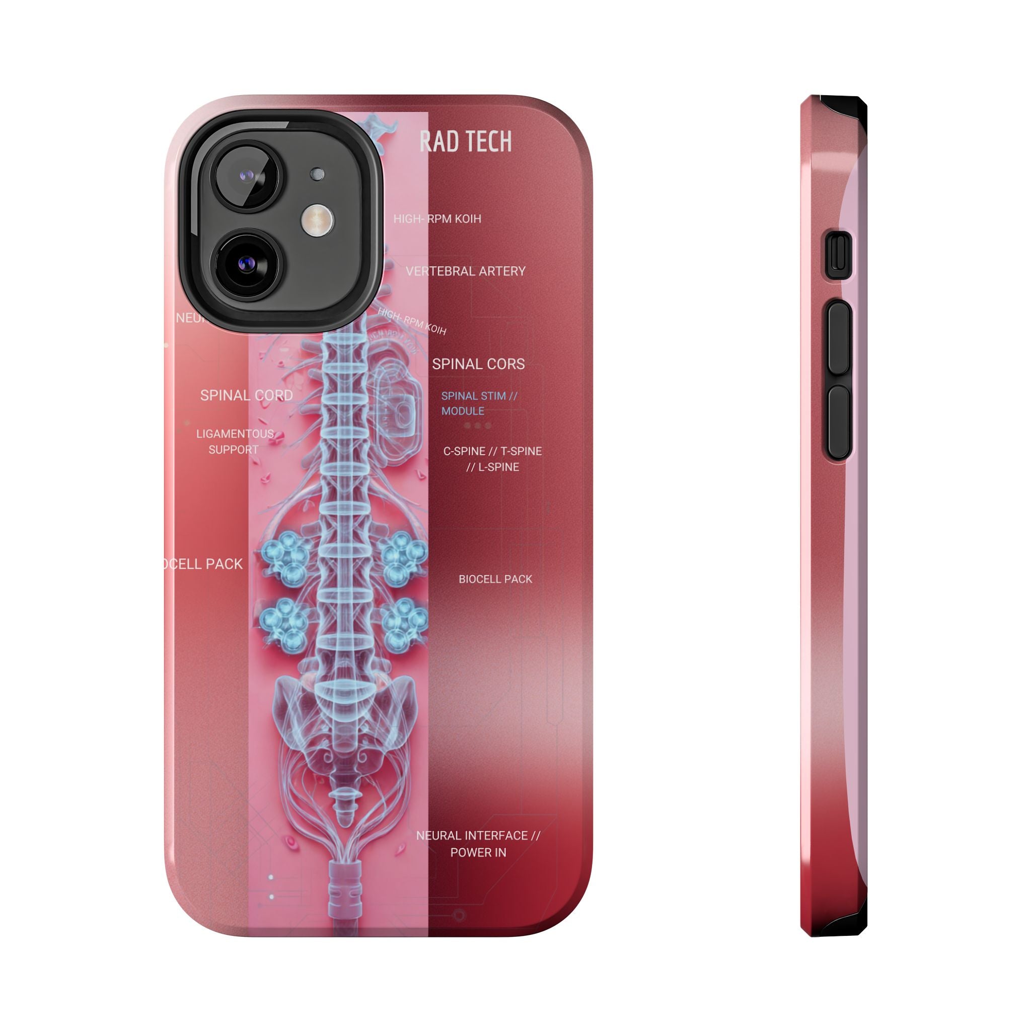Anatomical Spine Tough Phone Case — Medical X-Ray Design, ‘Spinal Cord’ Labelled