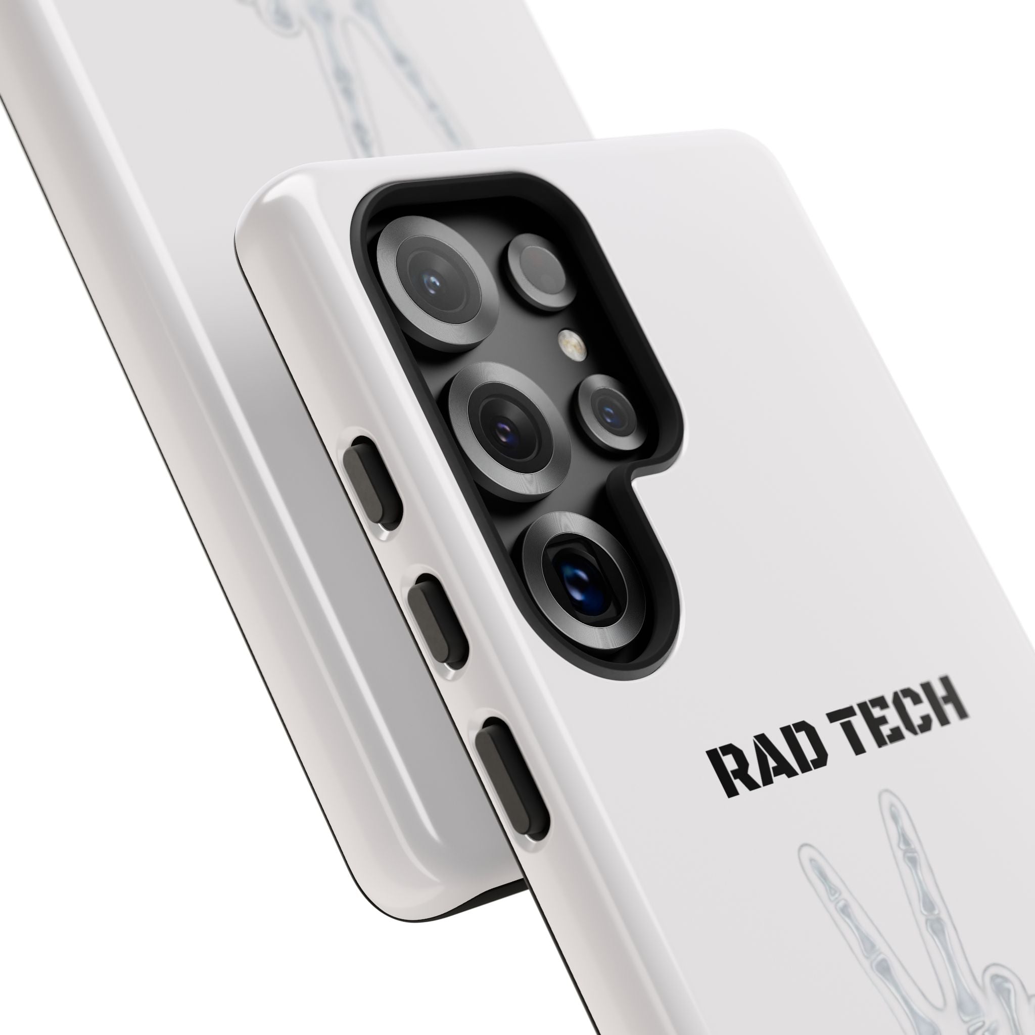 Rad Tech Phone Case — Skeleton Hand "I See Right Through You" X-ray Technician Gift