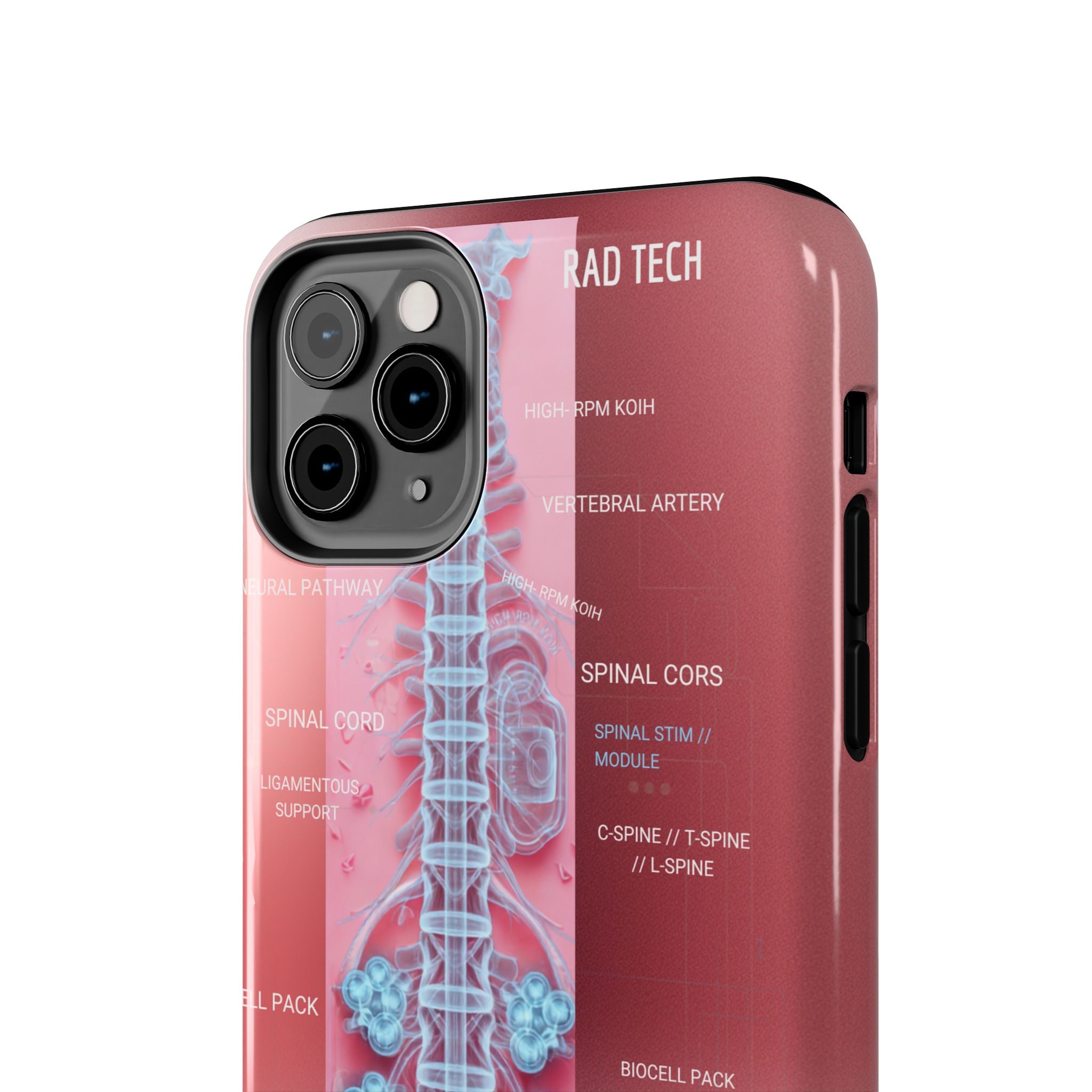 Anatomical Spine Tough Phone Case — Medical X-Ray Design, ‘Spinal Cord’ Labelled