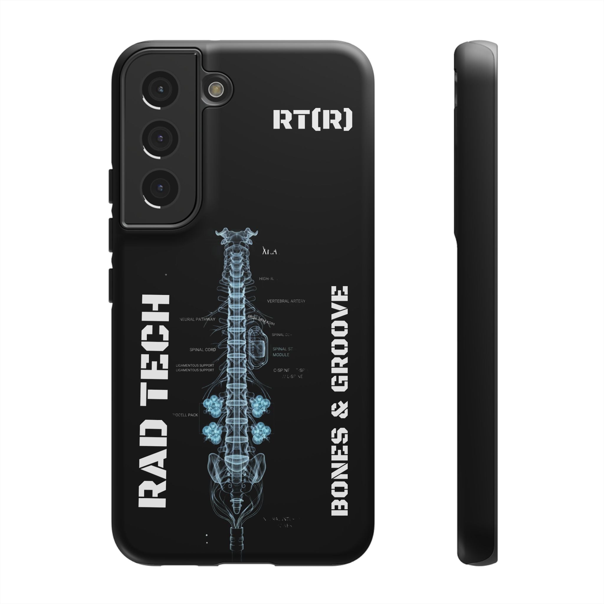 RAD TECH -Aesthetic Phone Case