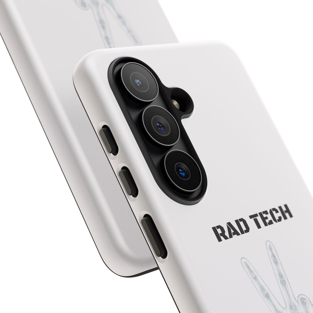 Rad Tech Phone Case — Skeleton Hand "I See Right Through You" X-ray Technician Gift