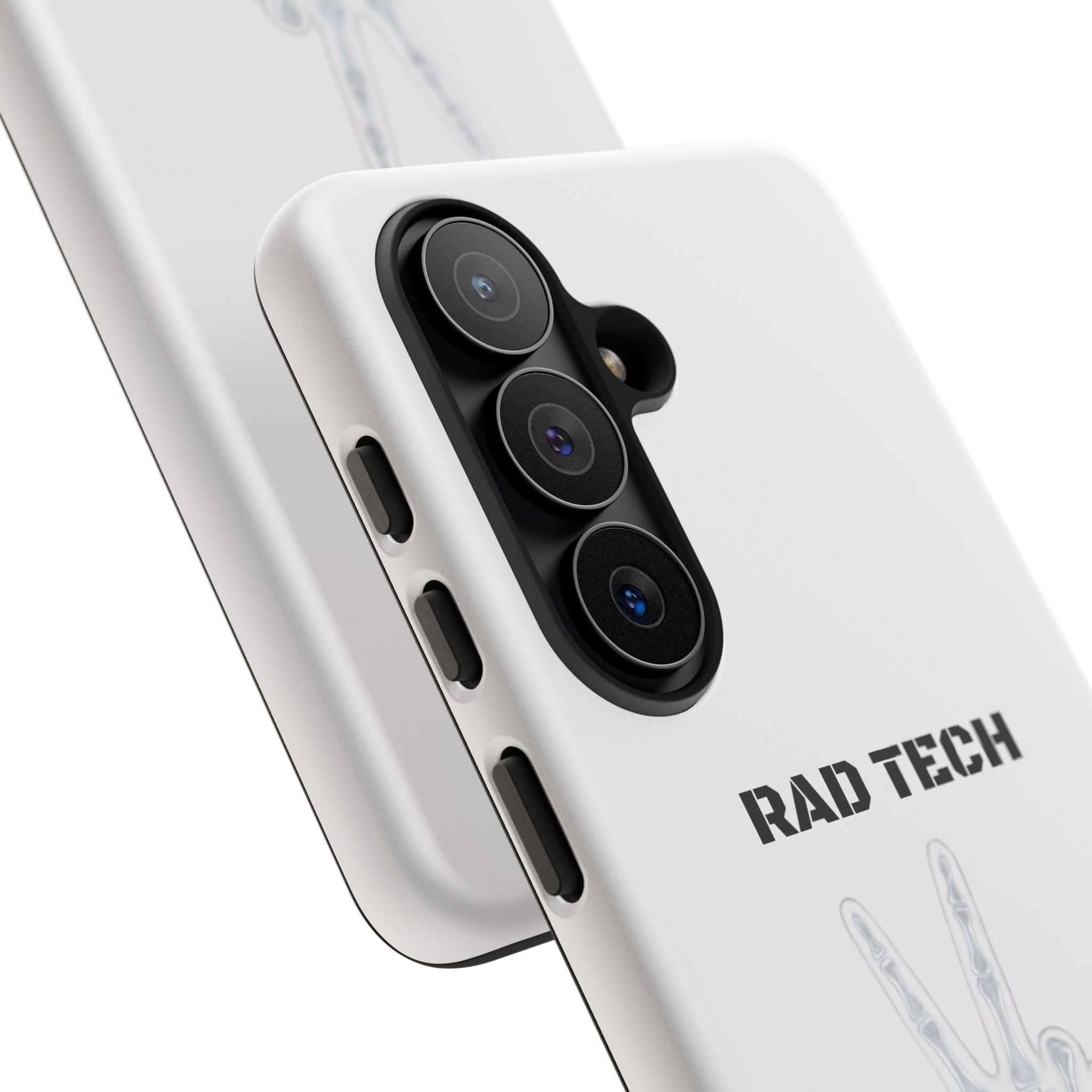 Rad Tech Phone Case — Skeleton Hand "I See Right Through You" X-ray Technician Gift