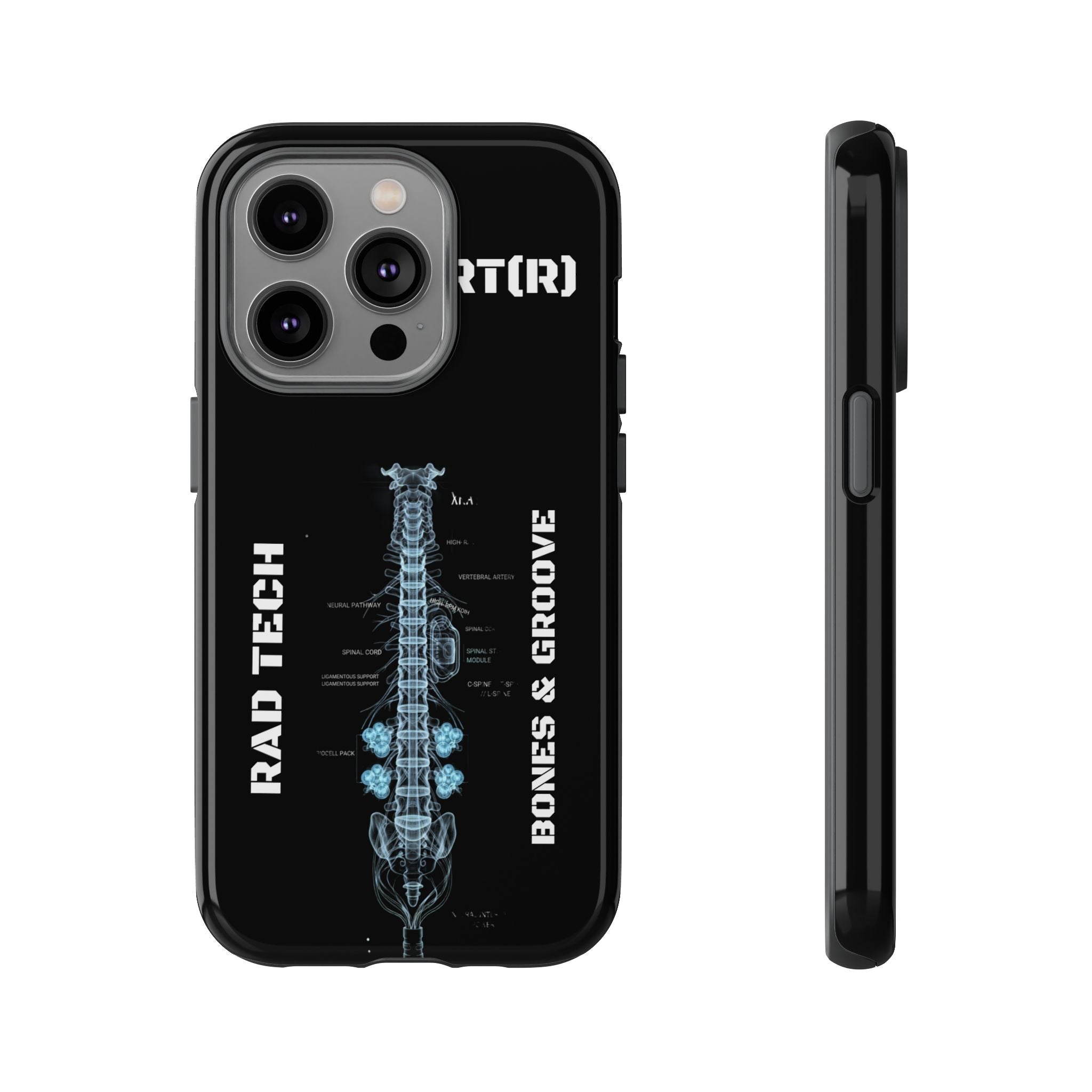RAD TECH -Aesthetic Phone Case