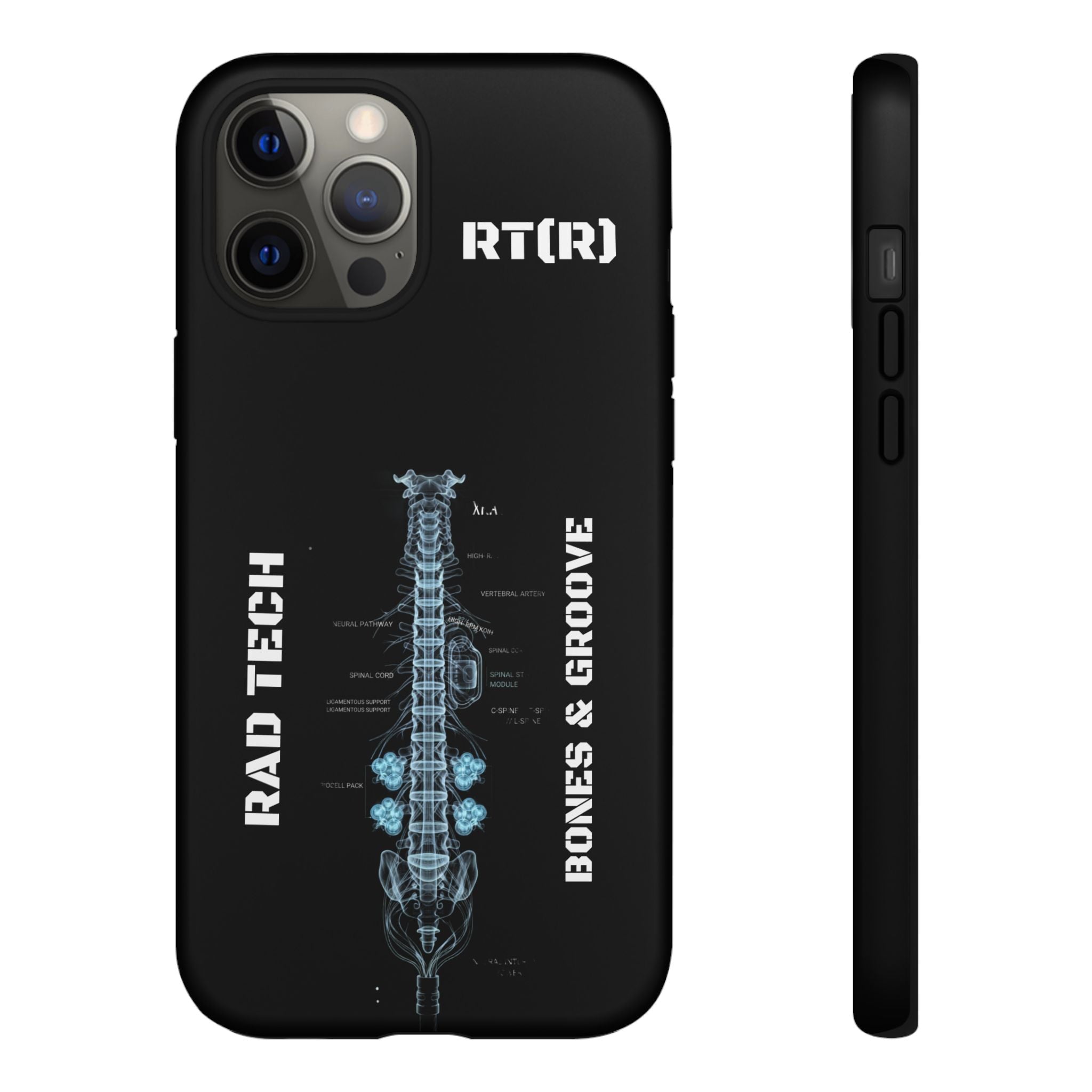 RAD TECH -Aesthetic Phone Case