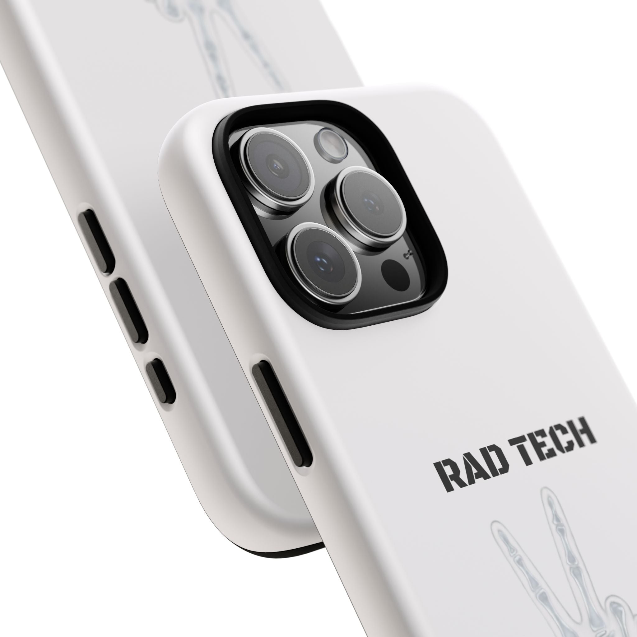 Rad Tech Phone Case — Skeleton Hand "I See Right Through You" X-ray Technician Gift