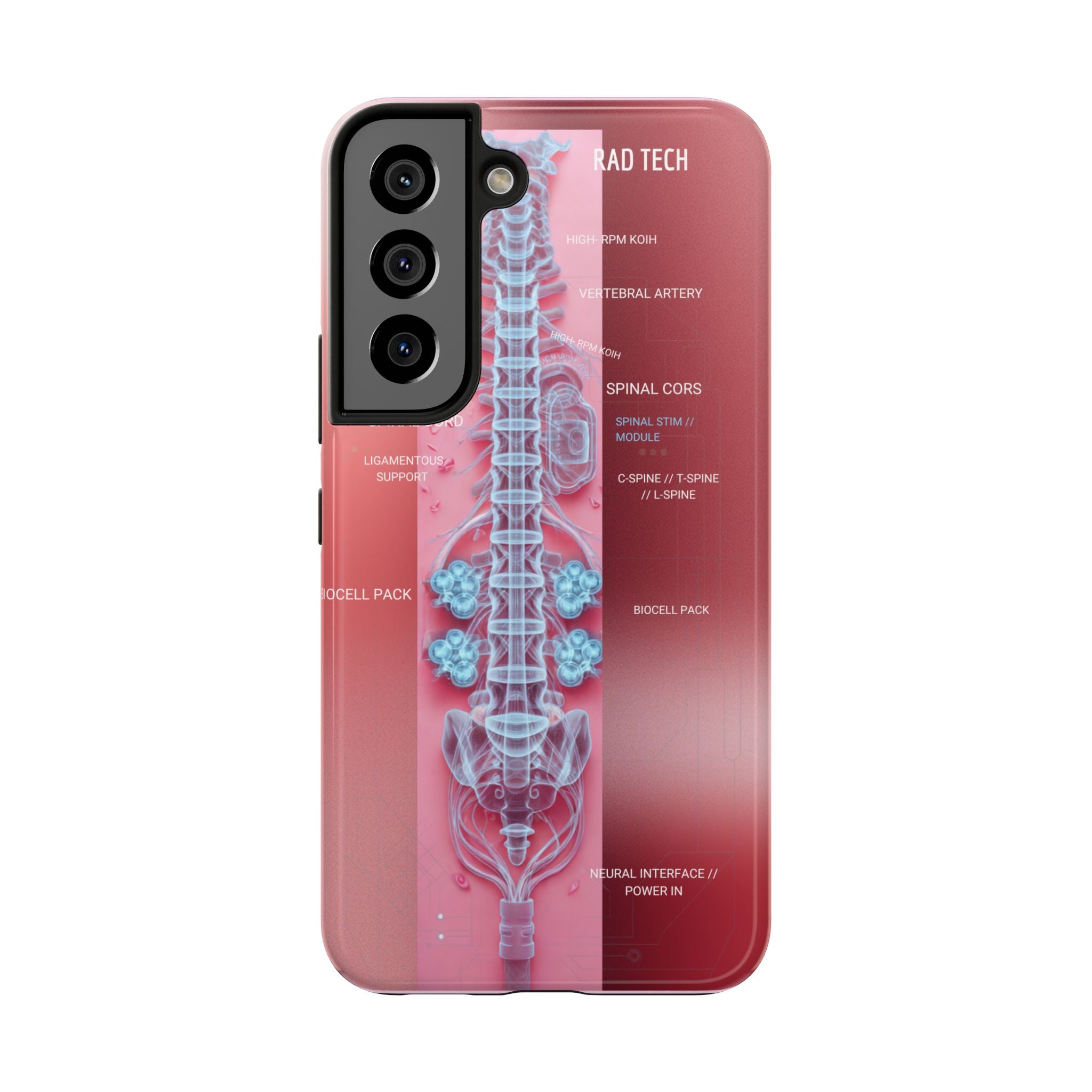 Anatomical Spine Tough Phone Case — Medical X-Ray Design, ‘Spinal Cord’ Labelled