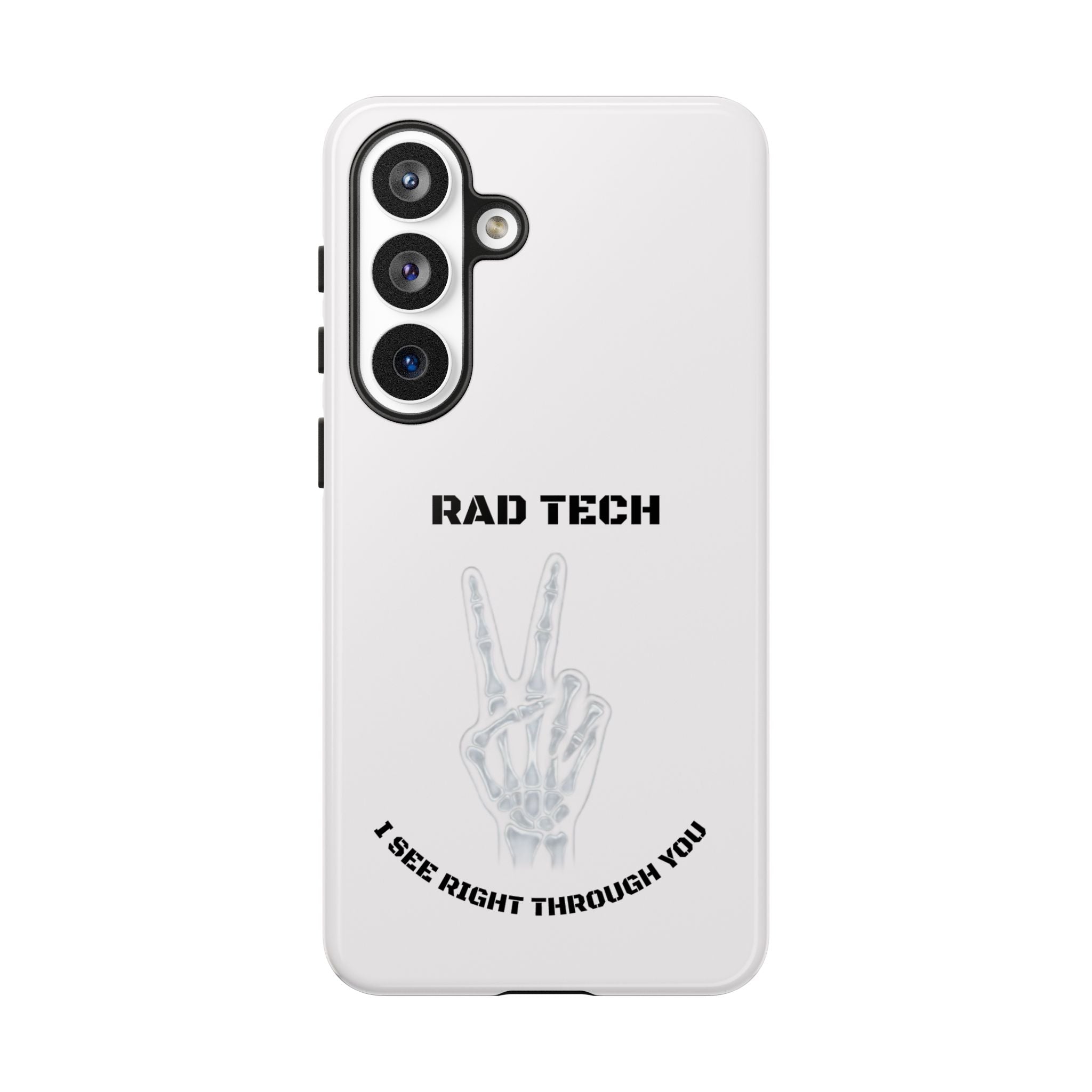 Rad Tech Phone Case — Skeleton Hand "I See Right Through You" X-ray Technician Gift