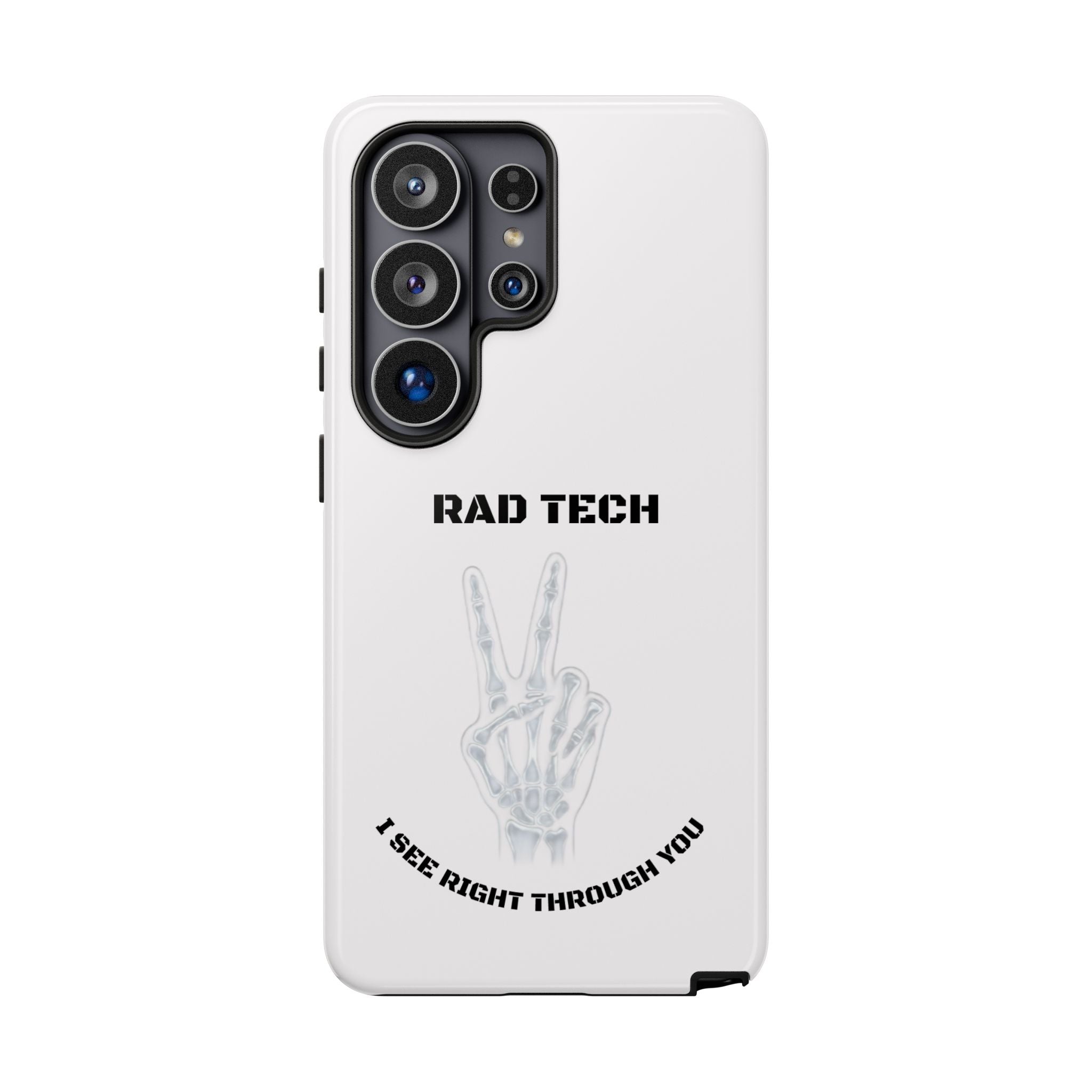 Rad Tech Phone Case — Skeleton Hand "I See Right Through You" X-ray Technician Gift