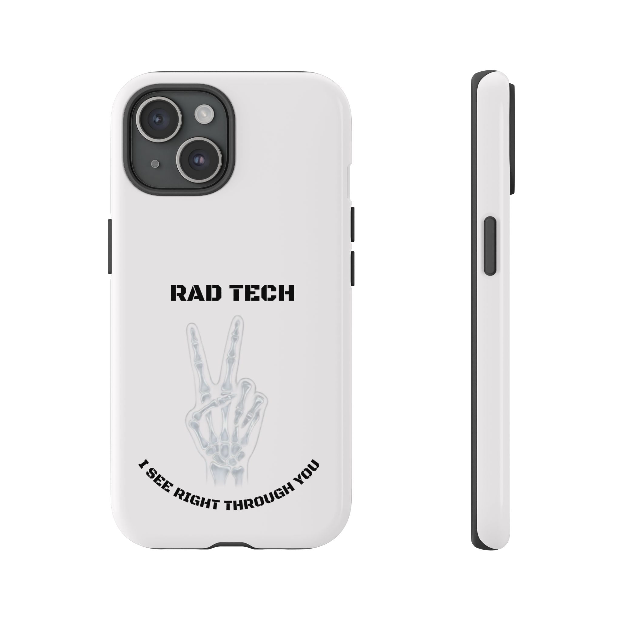 Rad Tech Phone Case — Skeleton Hand "I See Right Through You" X-ray Technician Gift