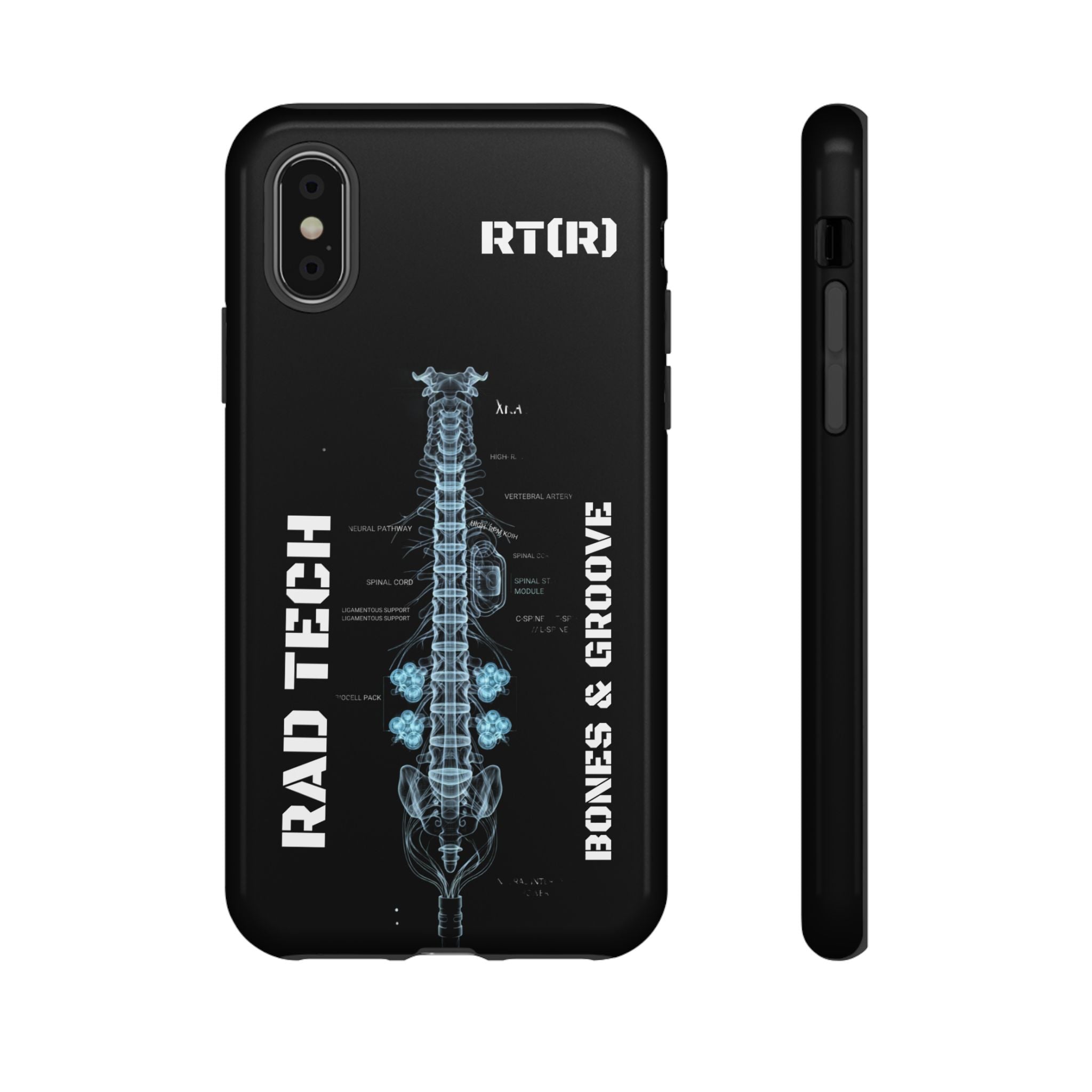 RAD TECH -Aesthetic Phone Case