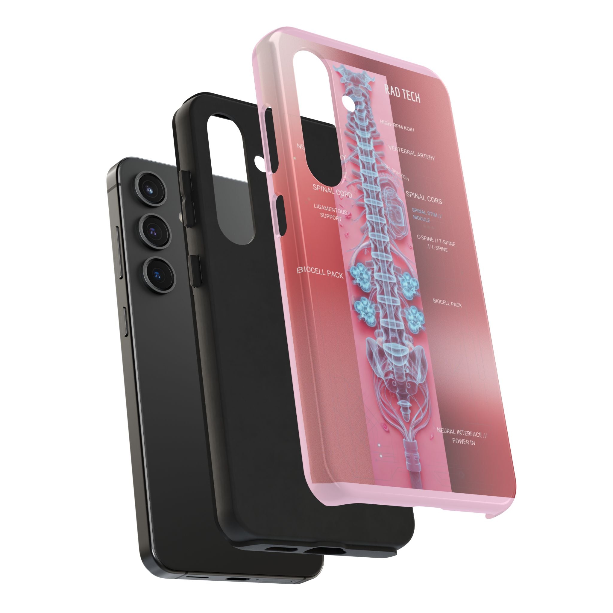 Anatomical Spine Tough Phone Case — Medical X-Ray Design, ‘Spinal Cord’ Labelled