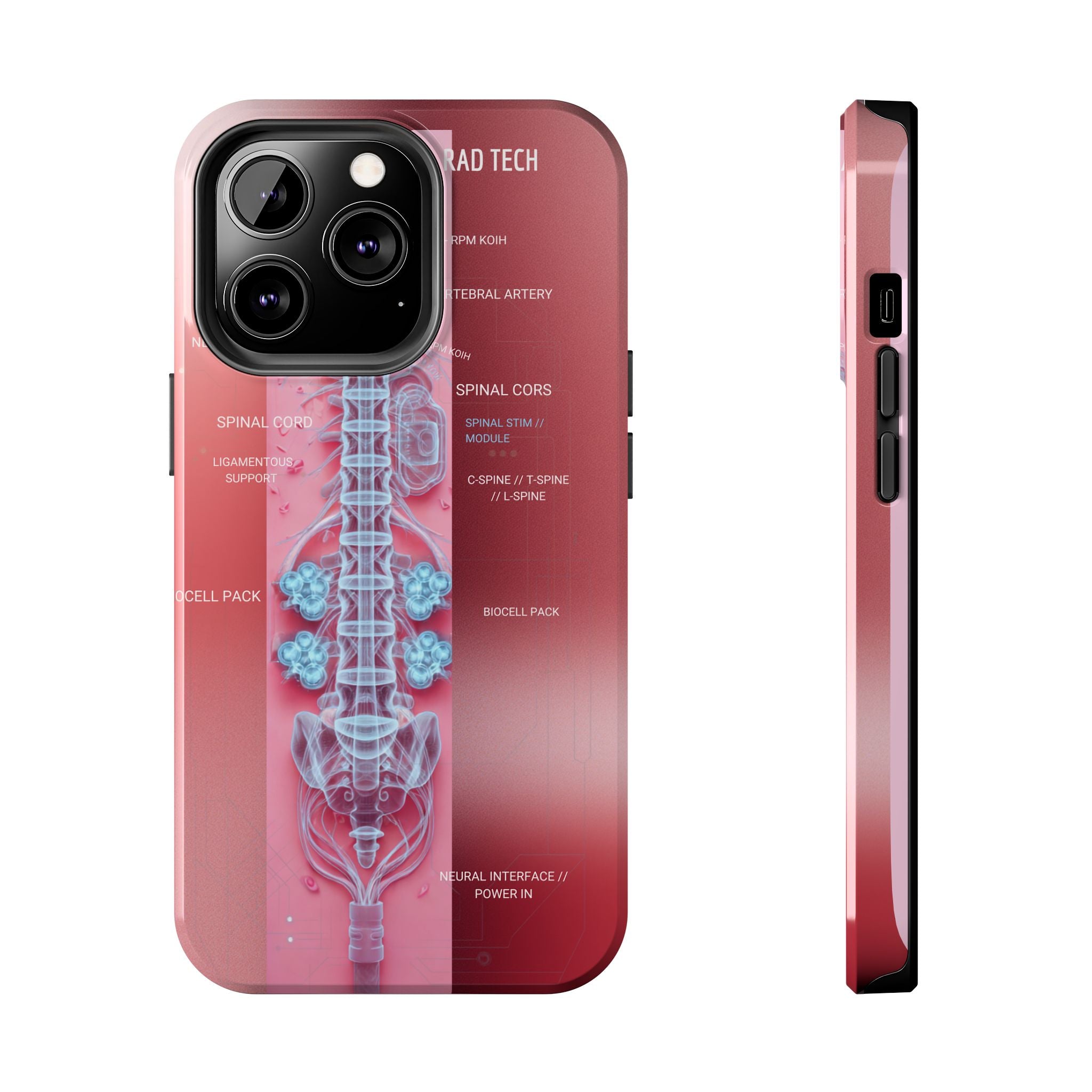 Anatomical Spine Tough Phone Case — Medical X-Ray Design, ‘Spinal Cord’ Labelled