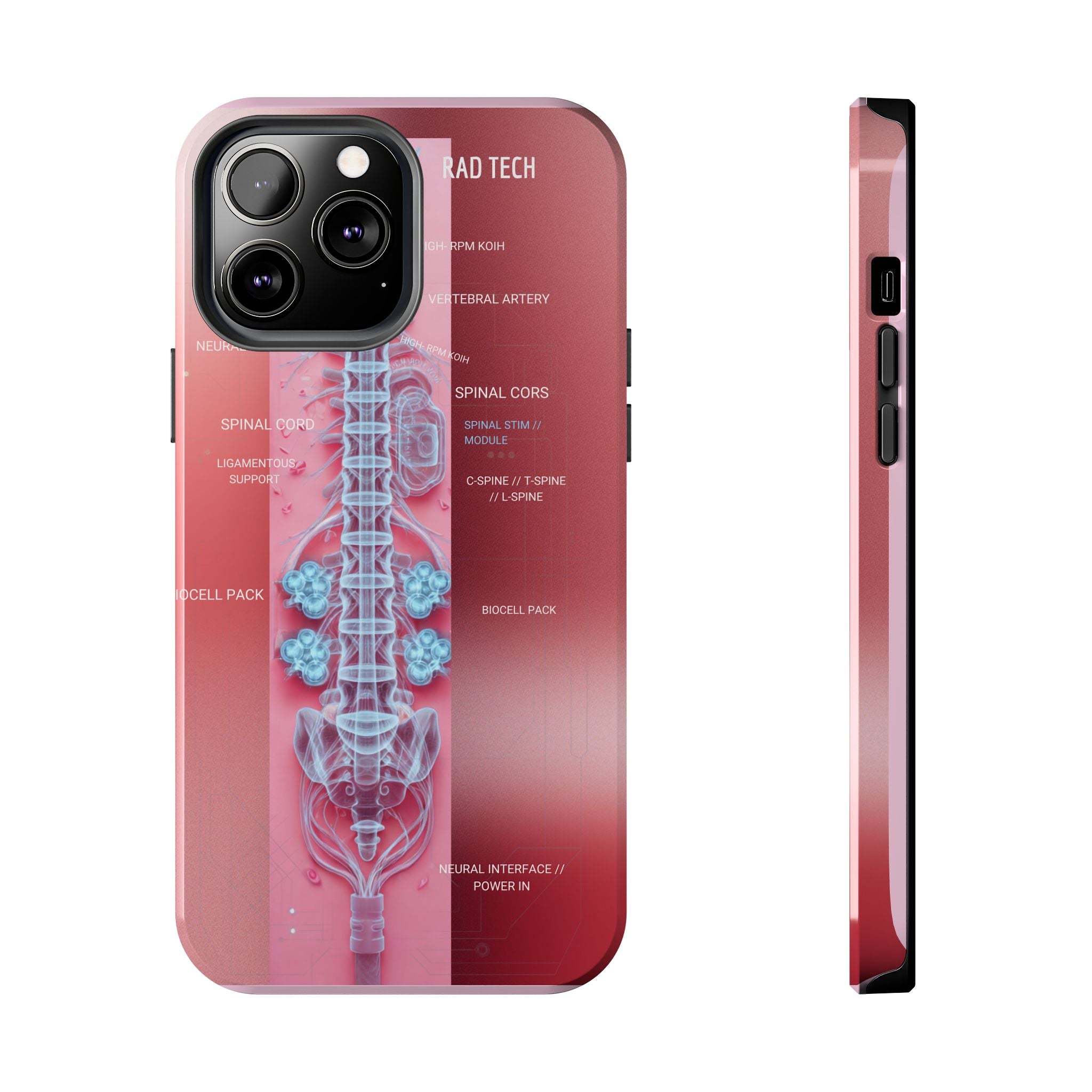 Anatomical Spine Tough Phone Case — Medical X-Ray Design, ‘Spinal Cord’ Labelled