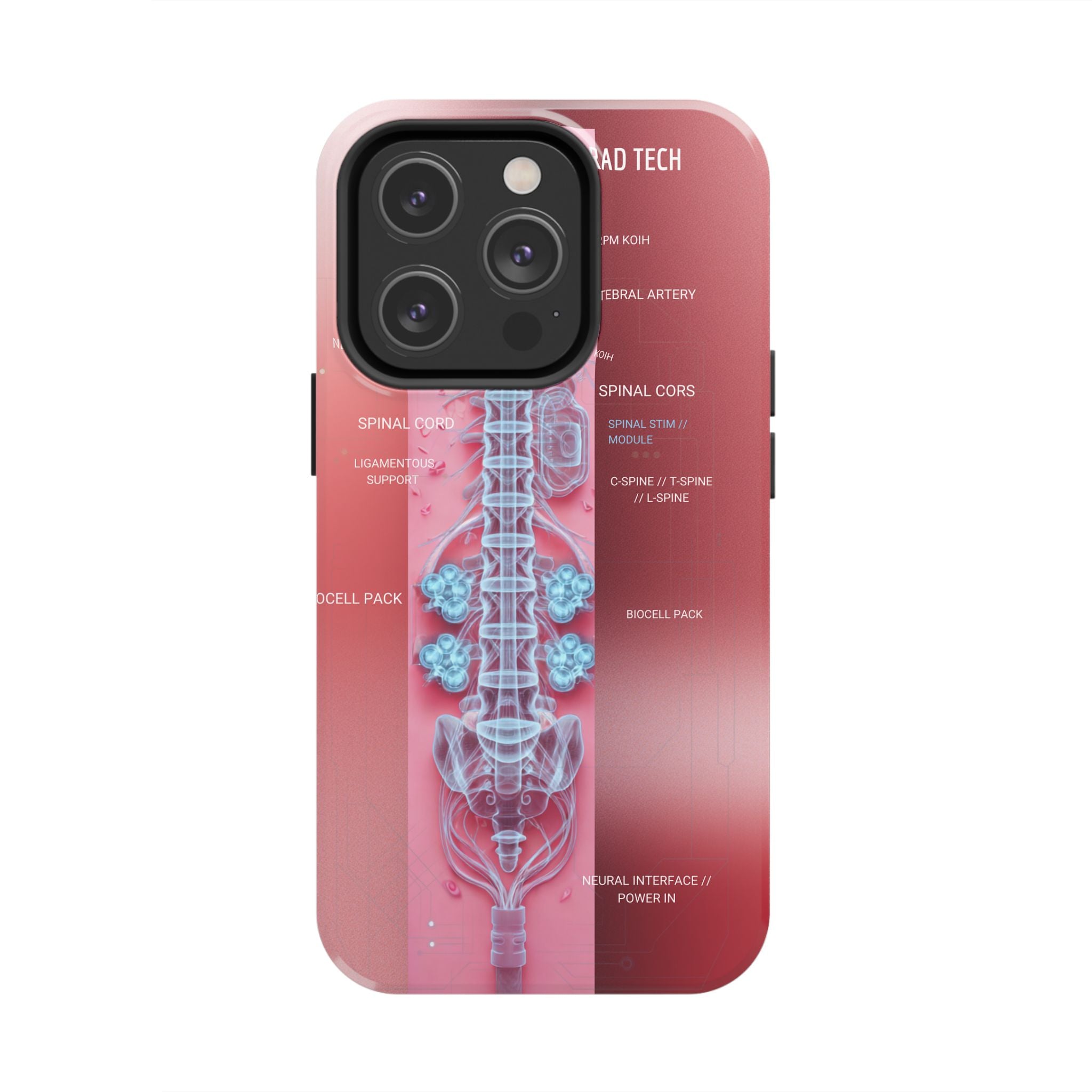 Anatomical Spine Tough Phone Case — Medical X-Ray Design, ‘Spinal Cord’ Labelled
