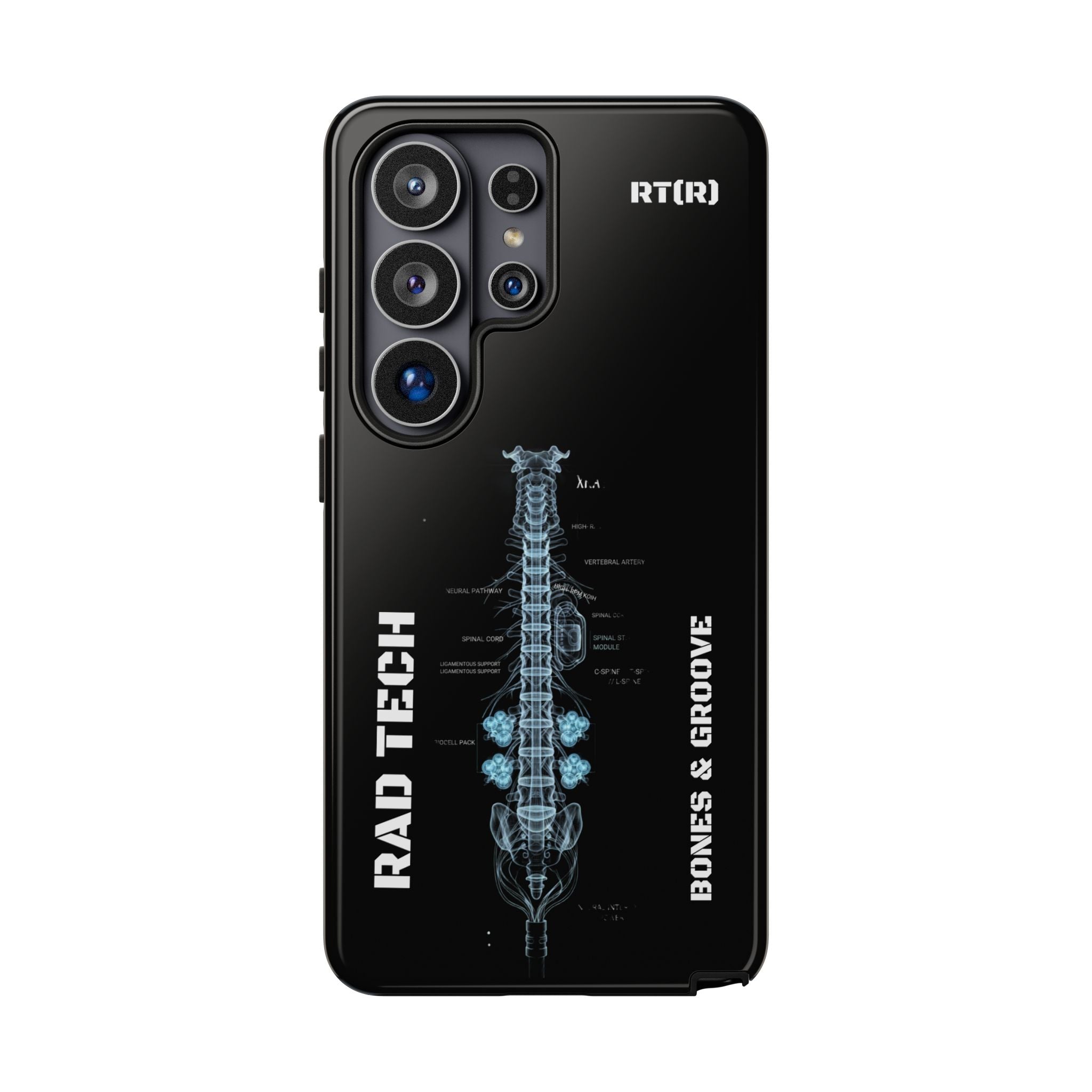 RAD TECH -Aesthetic Phone Case