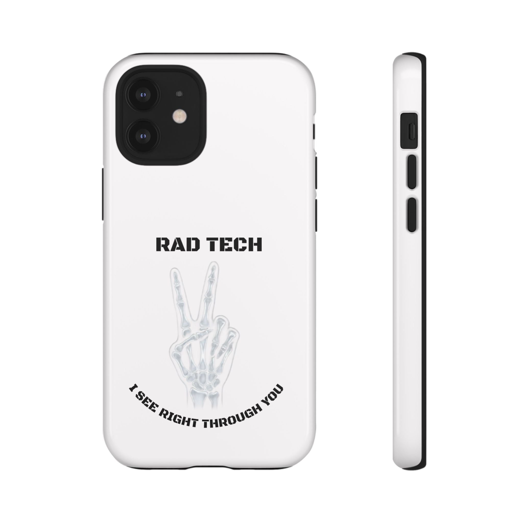 Rad Tech Phone Case — Skeleton Hand "I See Right Through You" X-ray Technician Gift