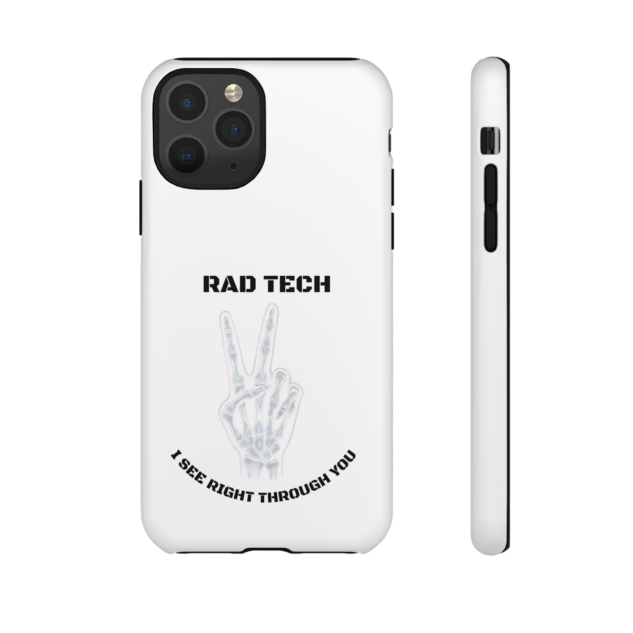 Rad Tech Phone Case — Skeleton Hand "I See Right Through You" X-ray Technician Gift