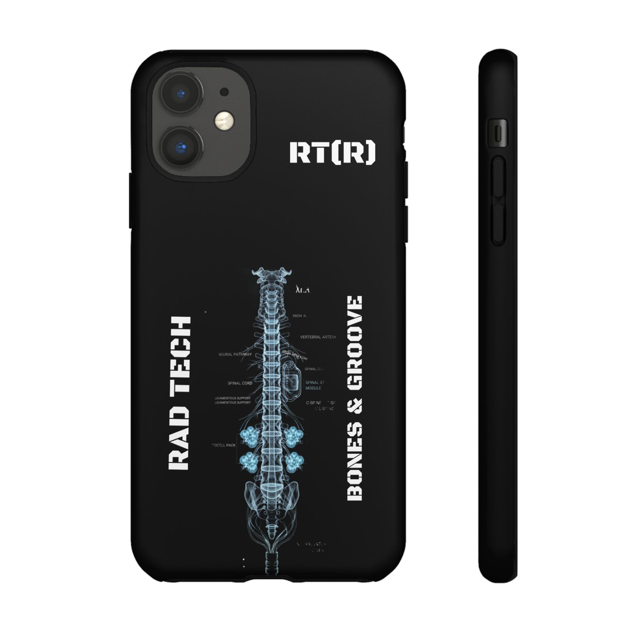 RAD TECH -Aesthetic Phone Case