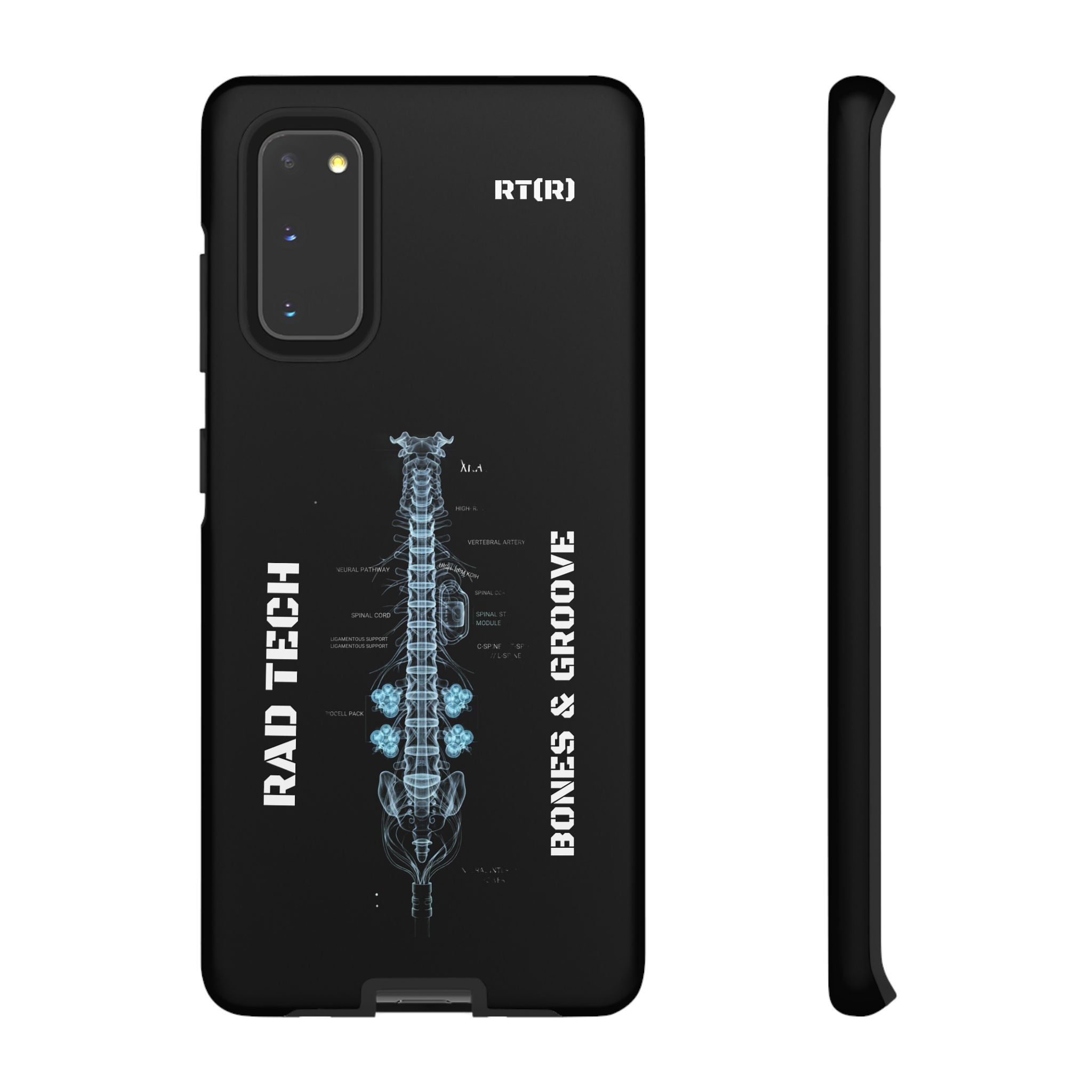 RAD TECH -Aesthetic Phone Case