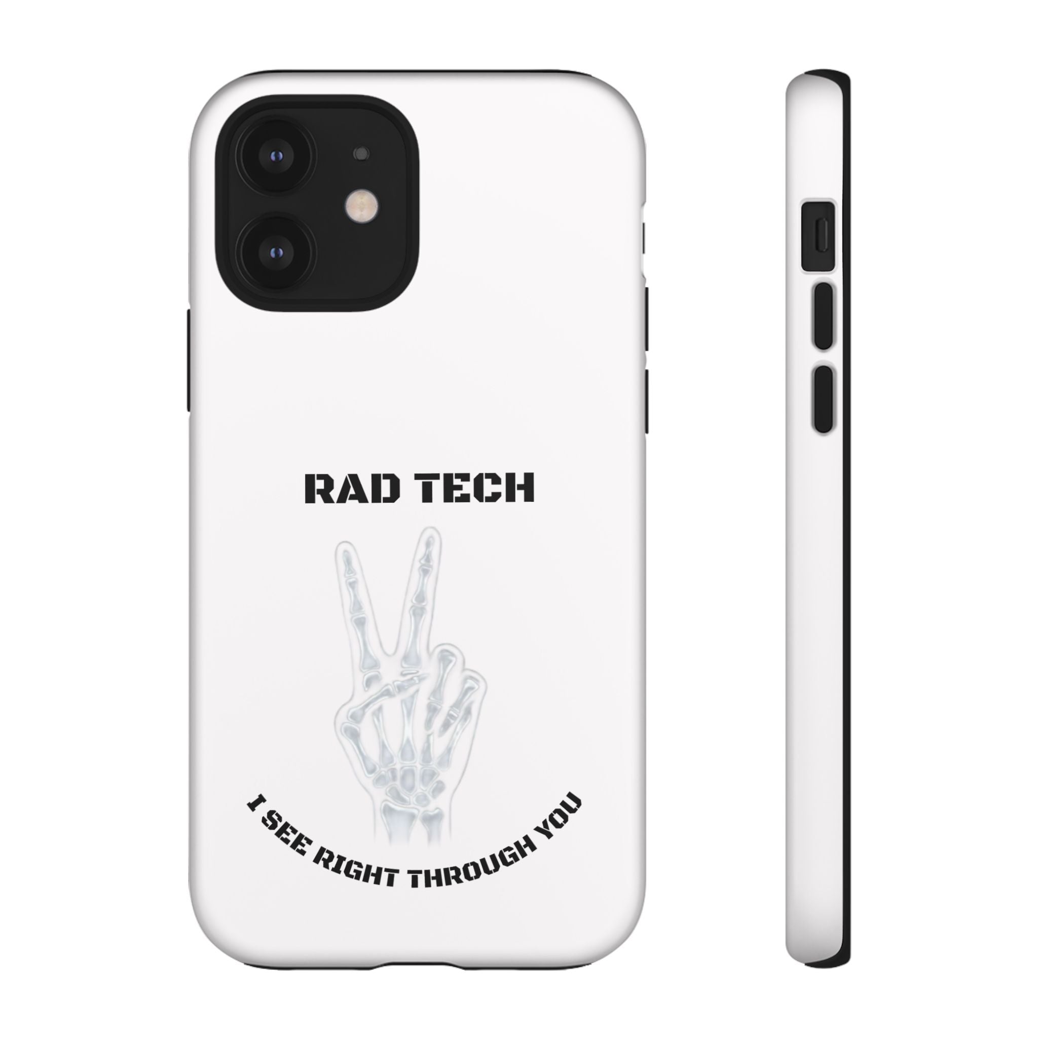 Rad Tech Phone Case — Skeleton Hand "I See Right Through You" X-ray Technician Gift