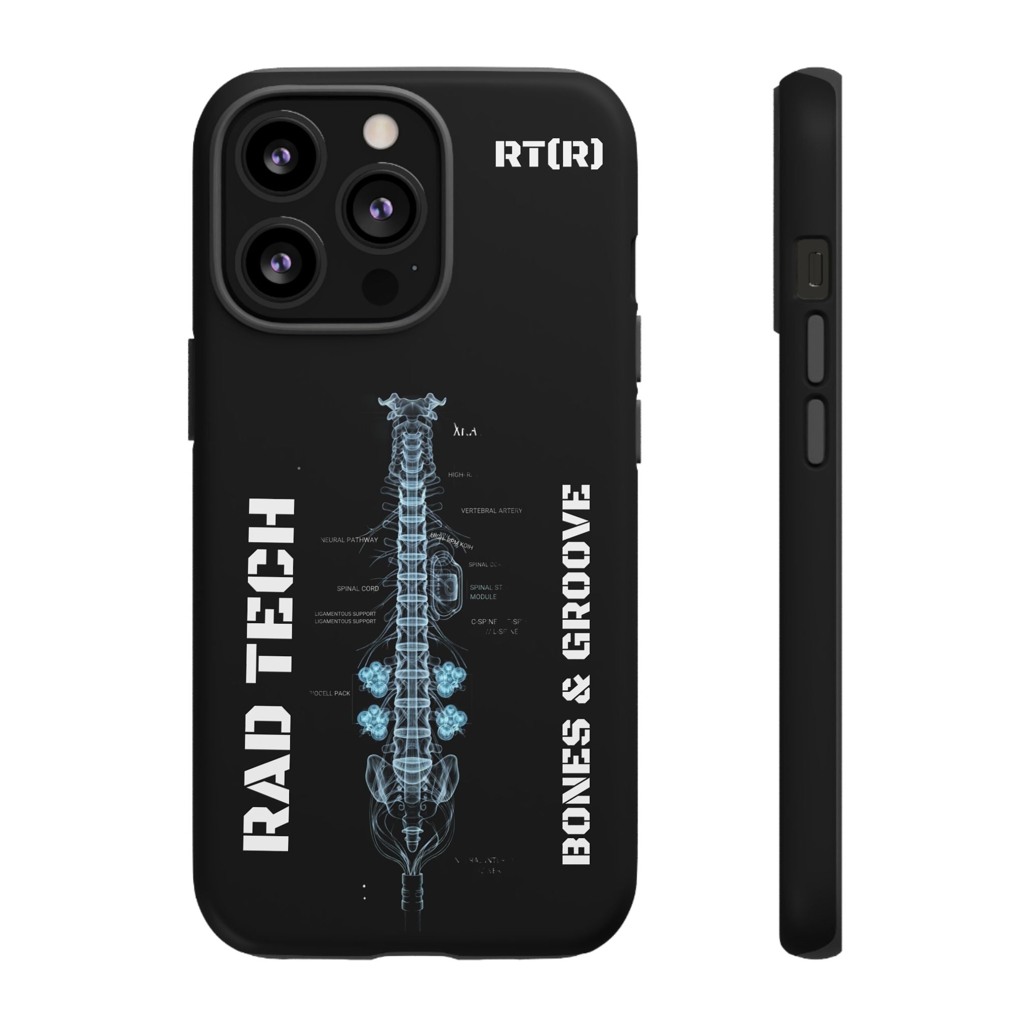 RAD TECH -Aesthetic Phone Case