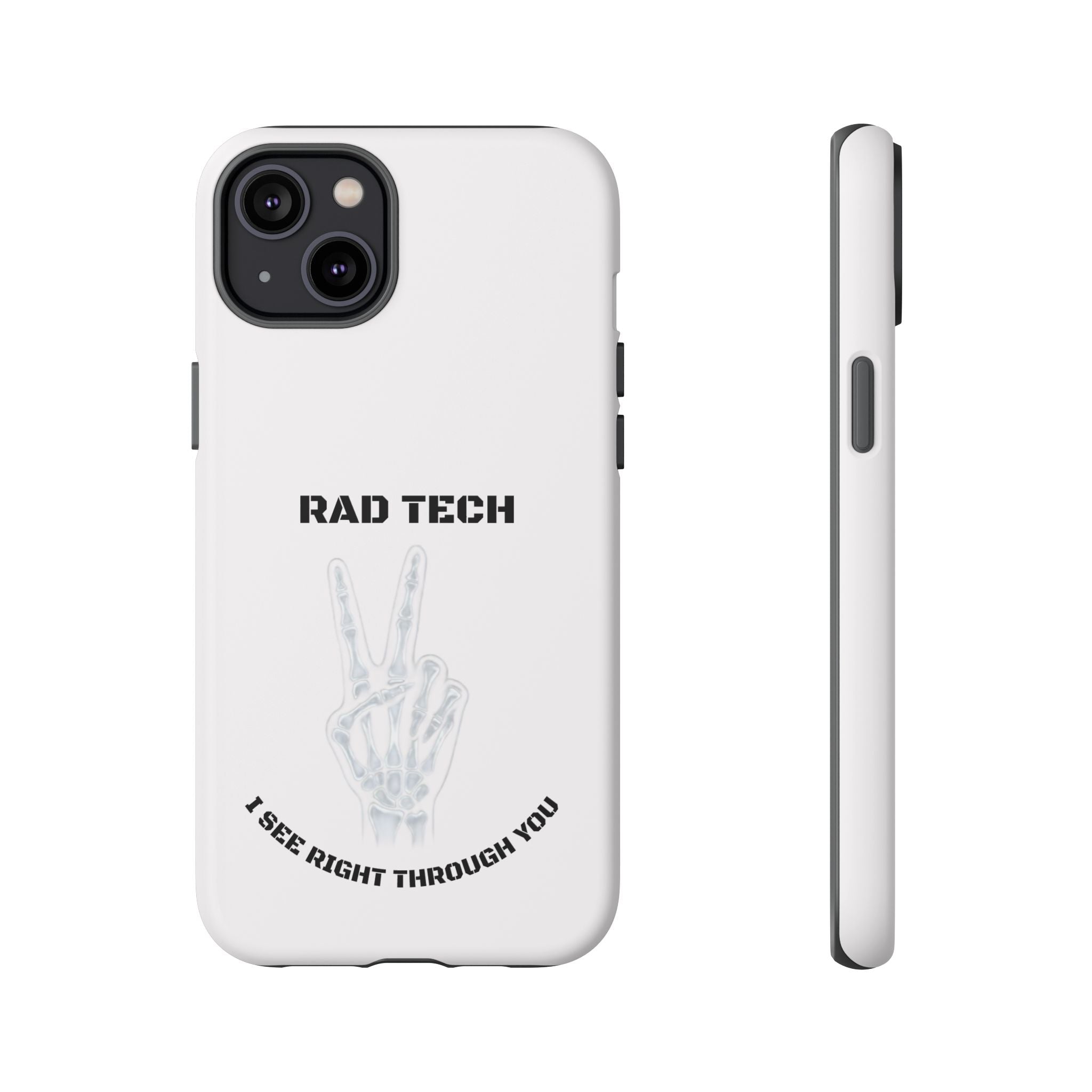 Rad Tech Phone Case — Skeleton Hand "I See Right Through You" X-ray Technician Gift