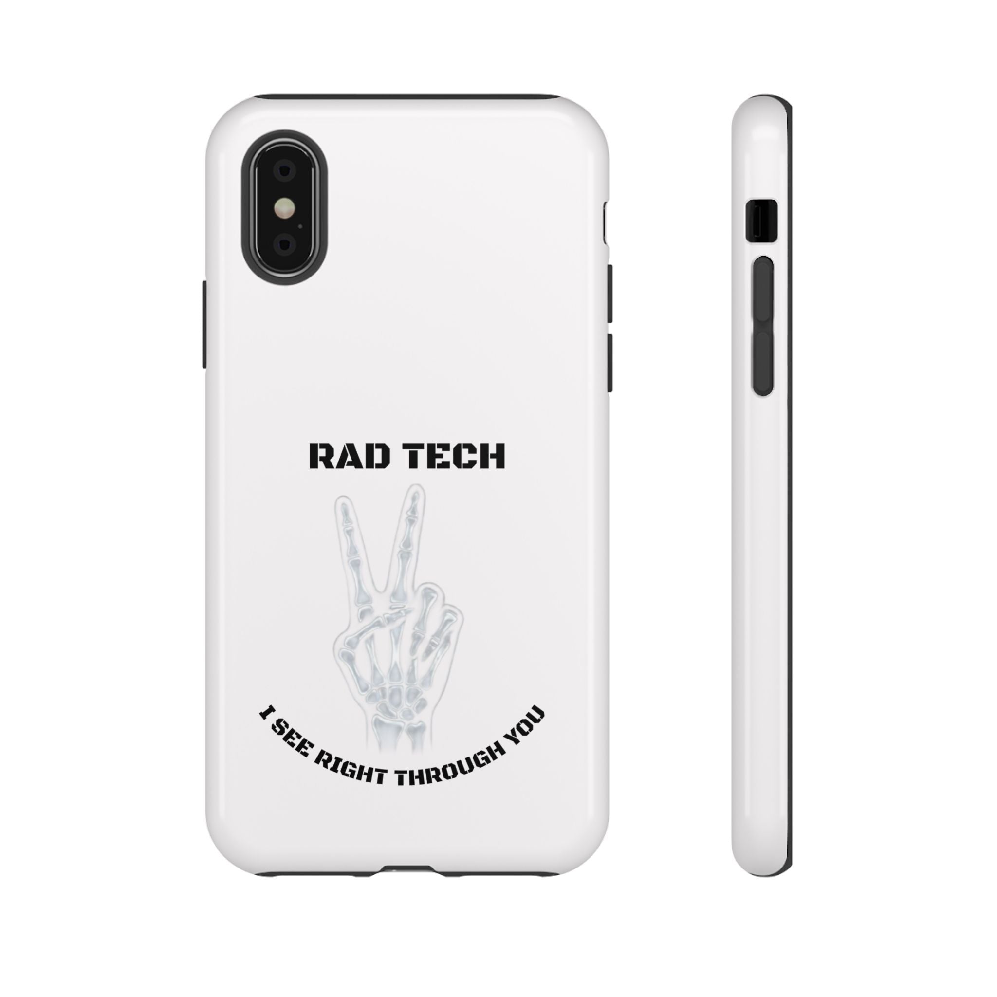 Rad Tech Phone Case — Skeleton Hand "I See Right Through You" X-ray Technician Gift