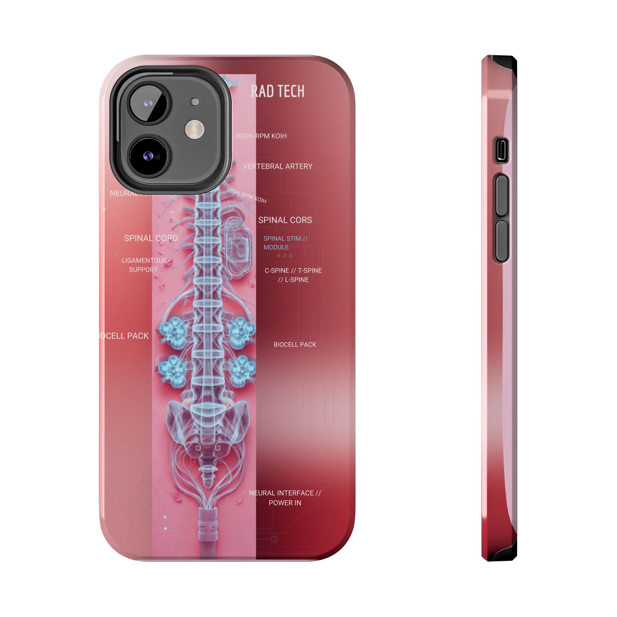 Anatomical Spine Tough Phone Case — Medical X-Ray Design, ‘Spinal Cord’ Labelled