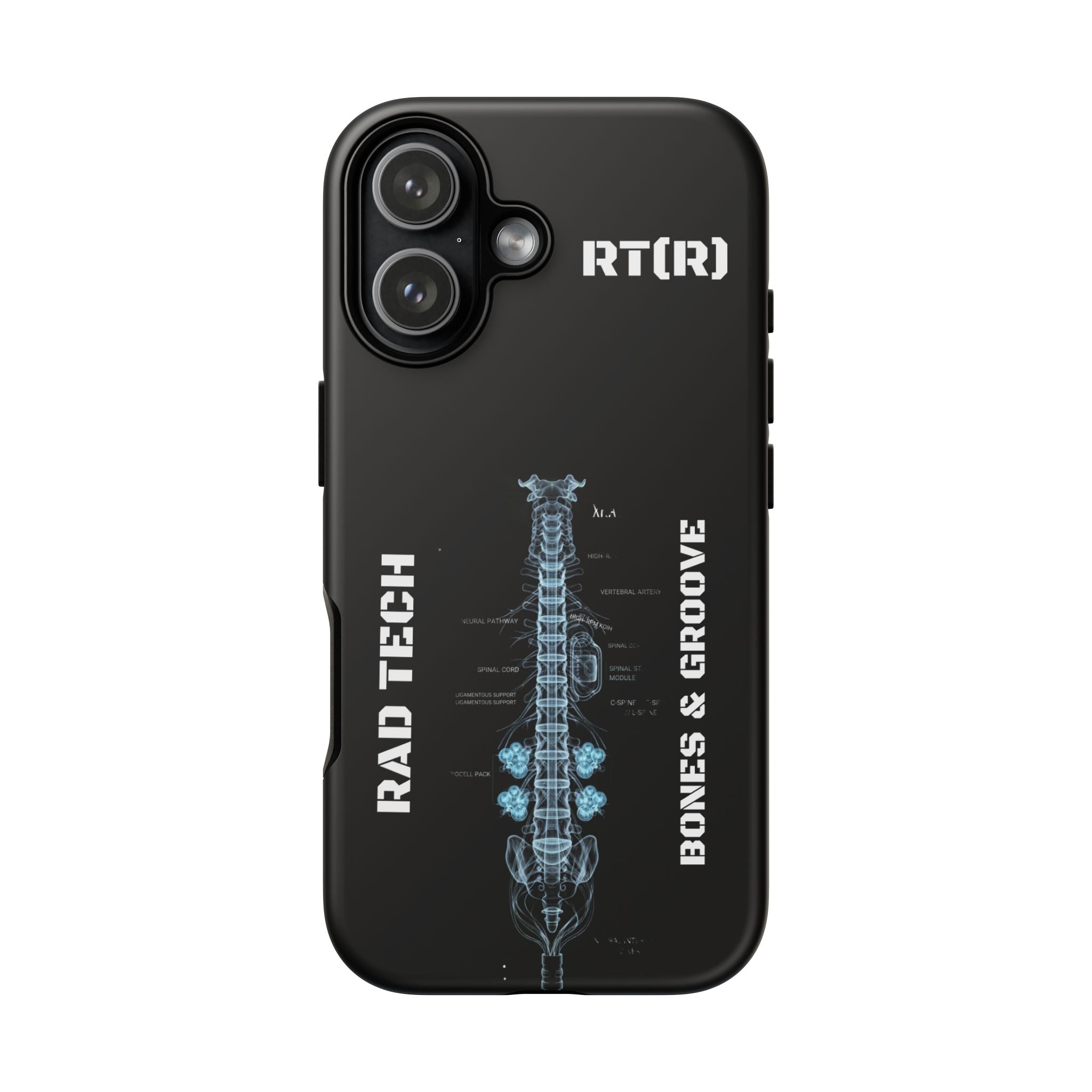 RAD TECH -Aesthetic Phone Case