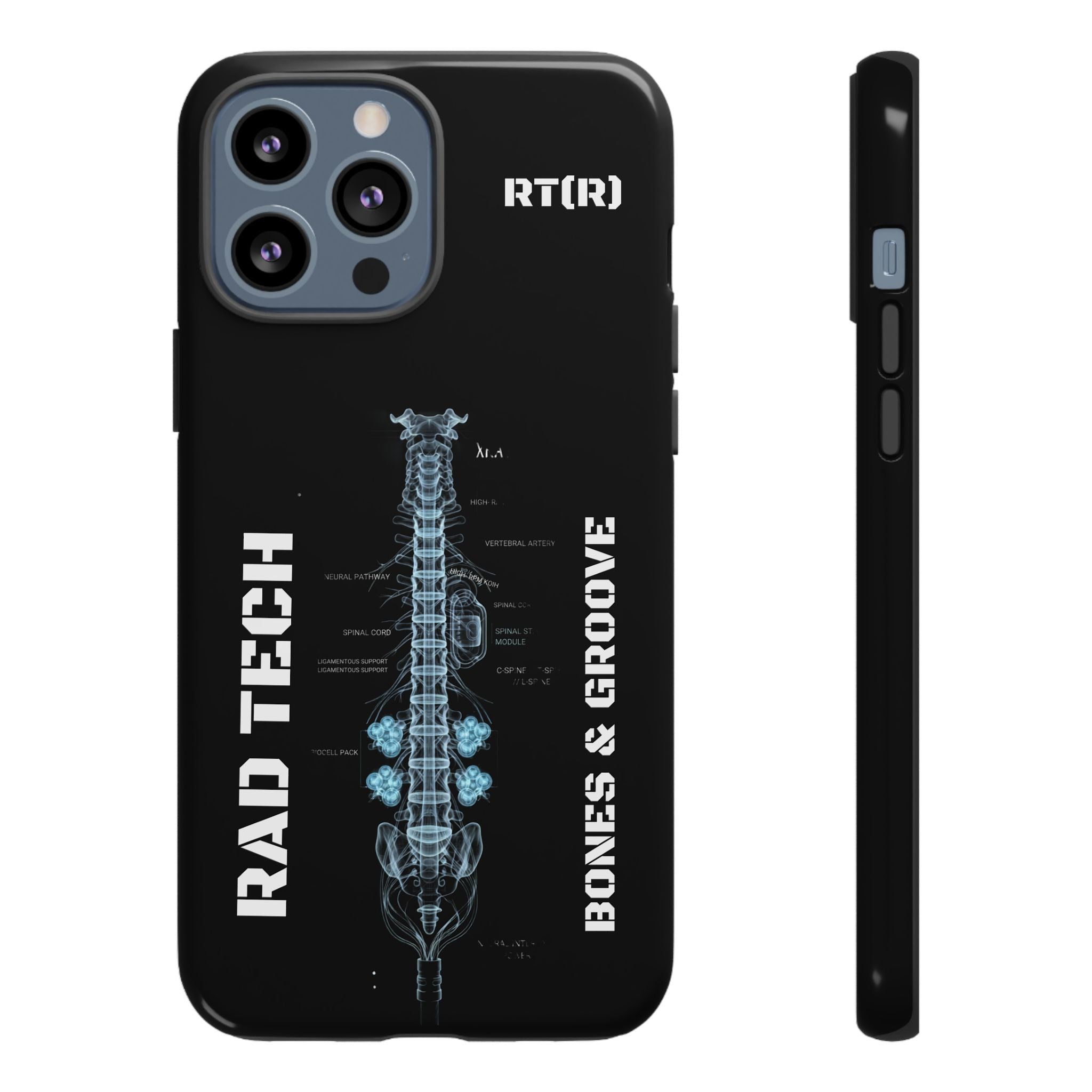 RAD TECH -Aesthetic Phone Case